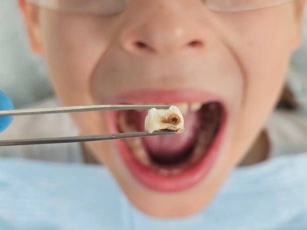 Best Emergency Broken Tooth Repair in Mount Clemens, MI